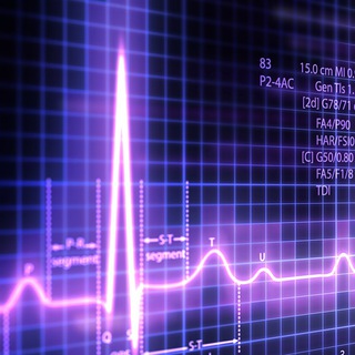 ECG Video